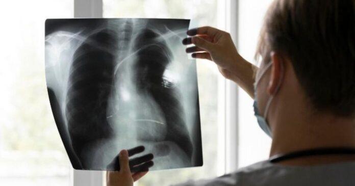 صحيفة اليوم العمانية - تقنية جديدة لتشخيص أمراض الرئة خلال دقائق